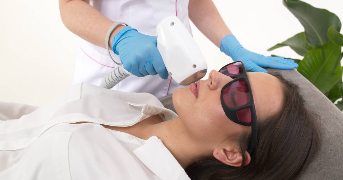 Kosmetolog depiluje wąsik laserem.